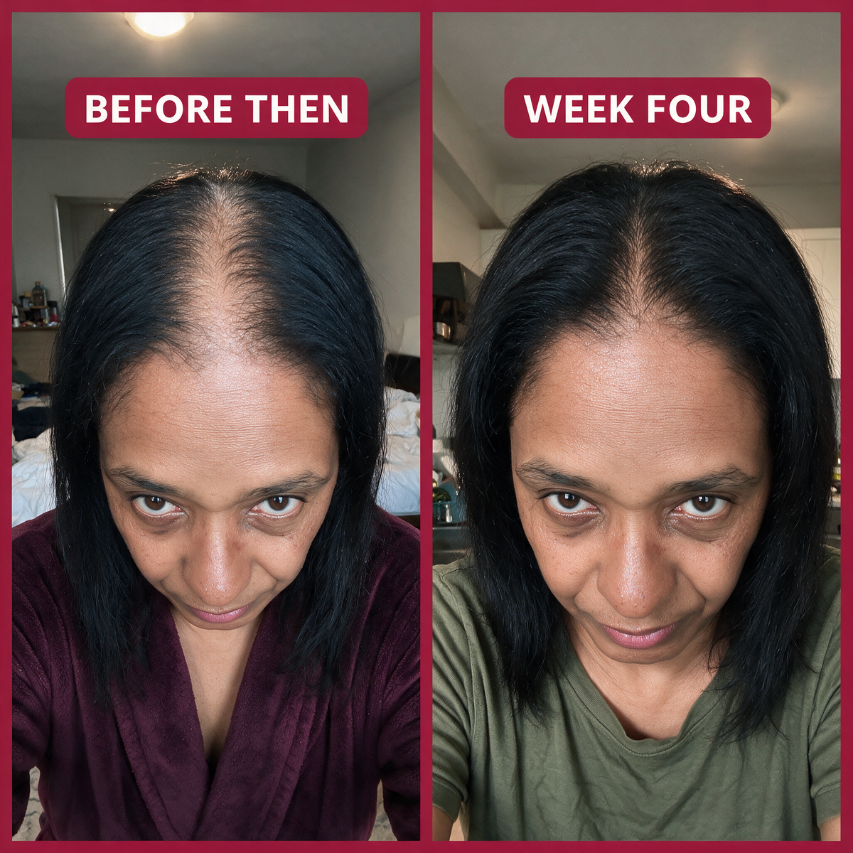 Rice Water X Rosemary Scalp Serum